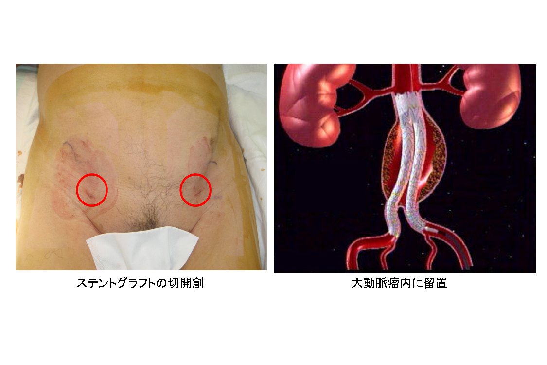 血管専門外来 血管外科 厚木市立病院